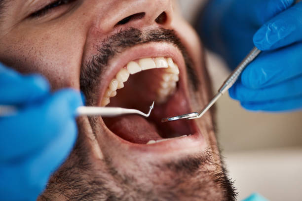 Best Walk-In Emergency Dental Services in Paris, KY